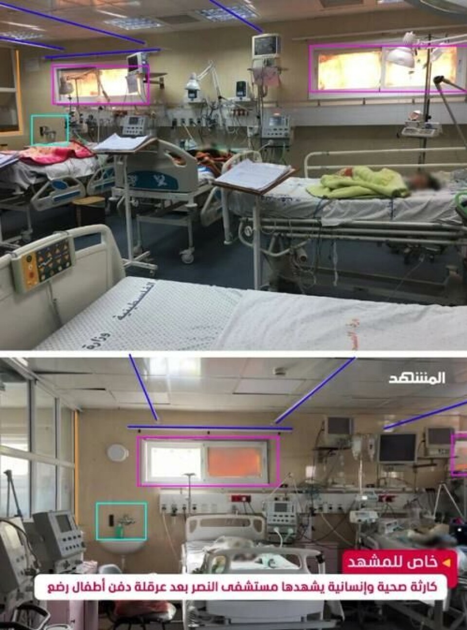 Ved å sammenlikne videoen med bilder fra sykehuset i 2018, ser vi at videoen er tatt på Al-Nasr barnesykehus. Skjermdump: Det palestinske helsedepartementet på Facebook (2018) og Al Mashhad (2023)