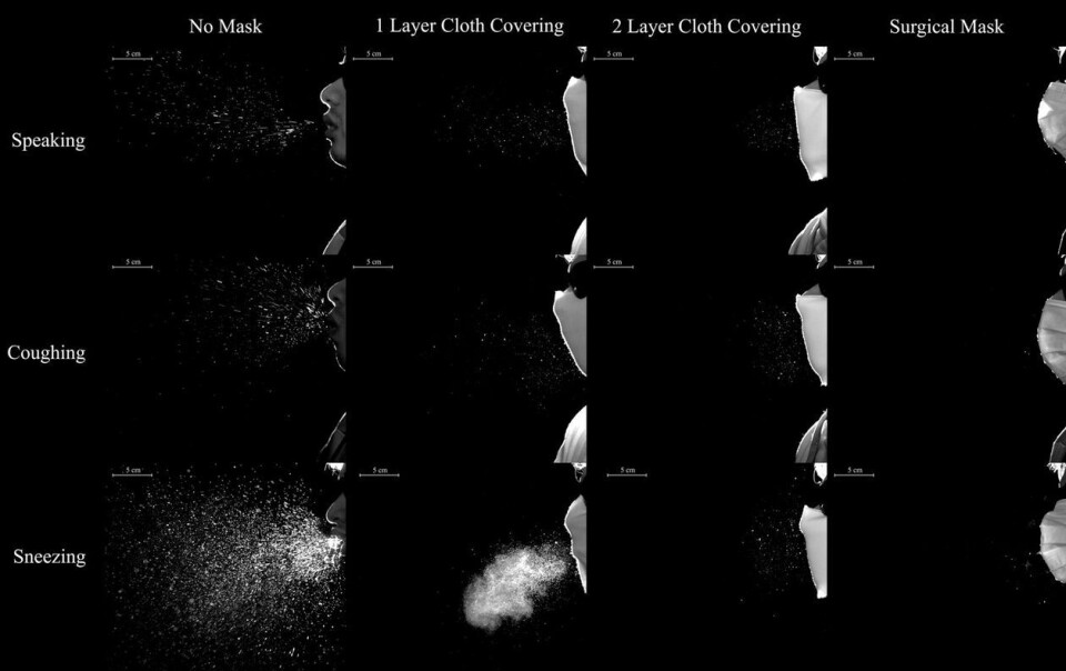 Undersøkelse av dråpespredning ved medisinsk munnbind, og ett eller to lag tekstiler, gjort av forskere i Australia. (bilde fra studien: Bahl P, Bhattacharjee S, de Silva C, et al: Face coverings and mask to minimise droplet dispersion and aerosolisation: a video case study – Thorax) Undersøkelse av dråpespredning ved medisinsk munnbind, og ett eller to lag tekstiler, gjort av forskere i Australia.