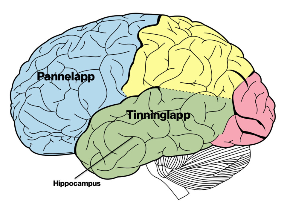 Illustrasjonen viser hvor pannelapp, eller frontallapp, og tinninglapp, eller temporallapp, er lokalisert i hjernen. Foto: Anatomy of the Human Body (1918), med Faktisk.nos påskrift Illustrasjonen viser hvor pannelapp, eller frontallapp, og tinninglapp, eller temporallapp, er lokalisert i hjernen.