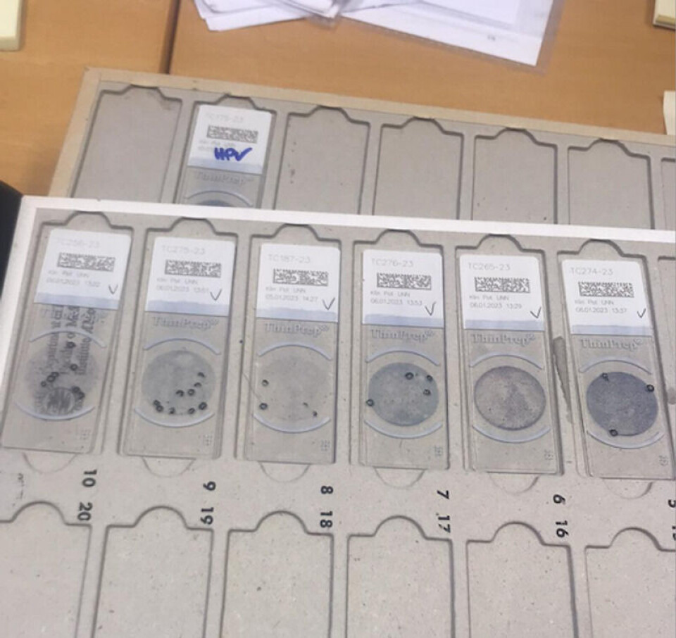 Bildet viser celleprøver der en bioingeniør har markert mulige celleforandringer, og sendt dem over til en patolog (legespesialist) for videre undersøkelse. Foto: Sveinung Sørbye, UNN